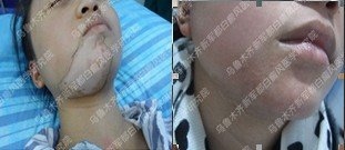 沿 ഺ