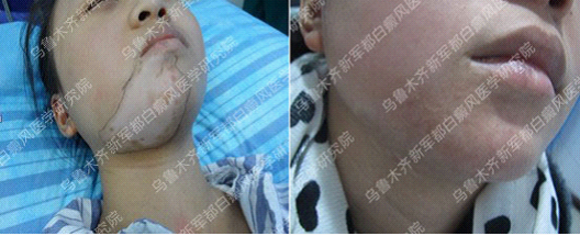 点击咨询在线专家